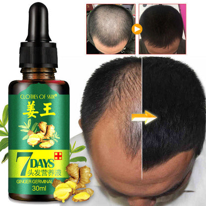 Intense Hair Growth Serum